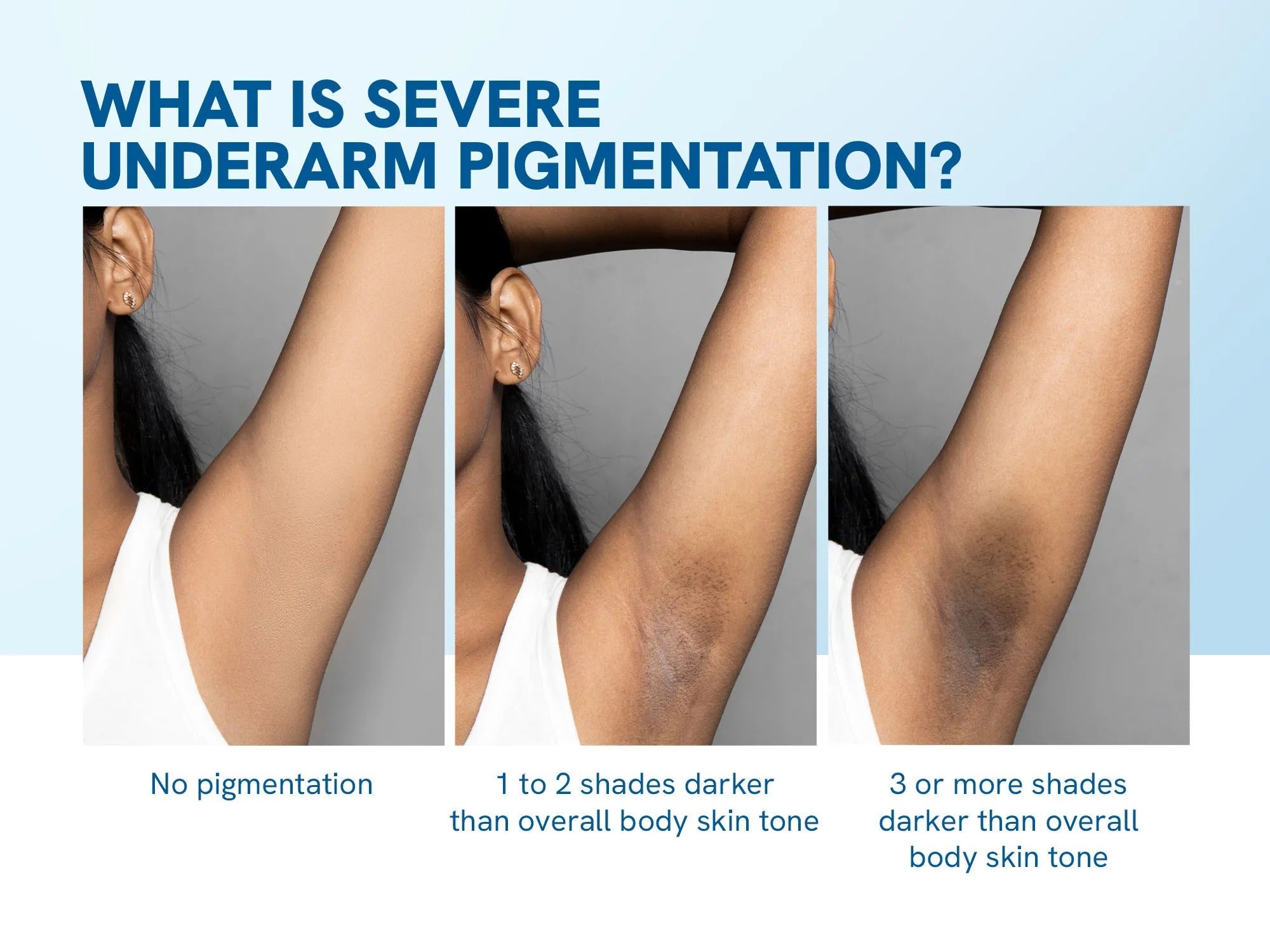 Underarm Pigmentation Kit - No Fragrance